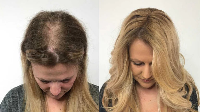 Feature product image