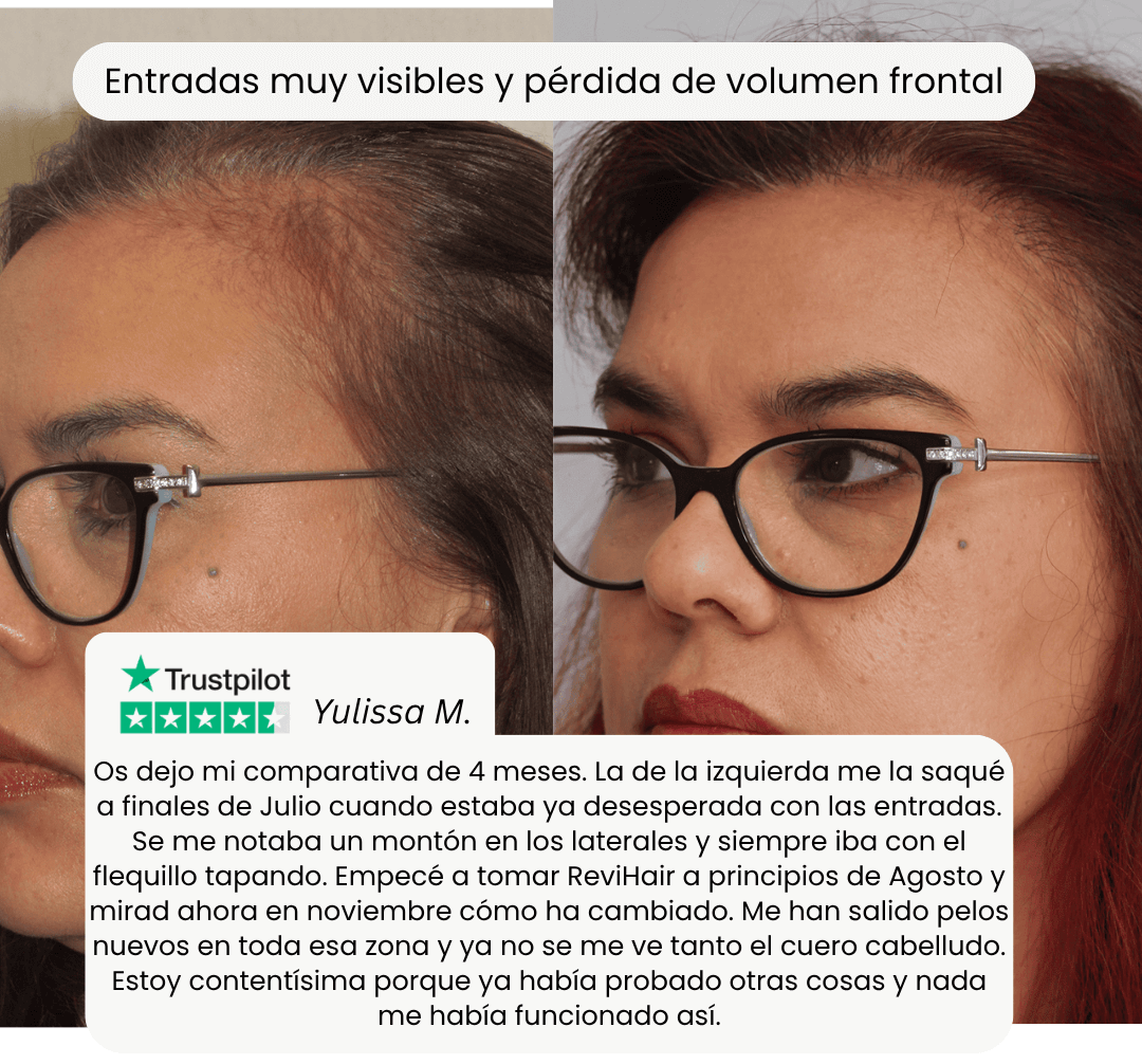 ReviHair | Restore your hair in 30 days