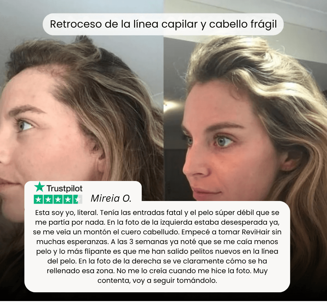 ReviHair | Recupera tu cabello en 30 días - therevitaliaofficial - 