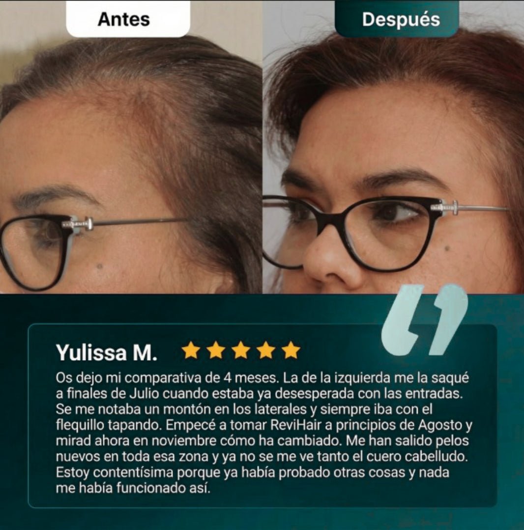 ReviHair | Recupera tu cabello en 30 días - therevitaliaofficial - 