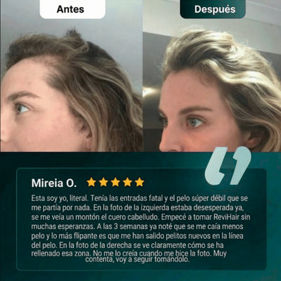 ReviHair | Recupera tu cabello en 30 días - therevitaliaofficial - 